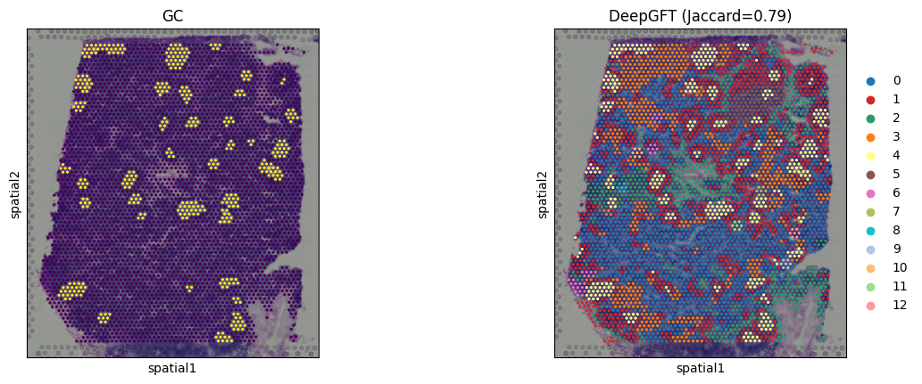 ../_images/notebook_5_Human_Lymph_Node_17_1.png